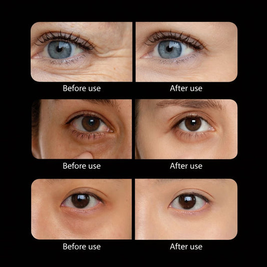 Sárriah Red Light Massager Eyeglasses